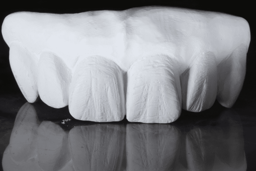 All-on-X Zirconia 2-day hands-on training.